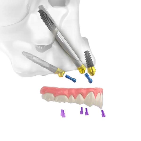 Noris Medical Pterygoid implantátum